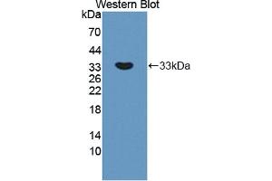 Western blot analysis of the recombinant protein. (APBA2 抗体  (AA 459-722))