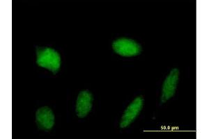 Immunofluorescence of purified MaxPab antibody to STAT5A on HeLa cell. (STAT5A 抗体  (AA 1-794))