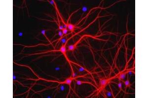 Immunofluorescence - MAP2 Antibody. (MAP2 抗体)