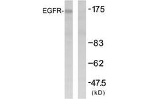 Western blot analysis of extracts from HuvEc cells, using EGFR (Ab-1092) Antibody. (EGFR 抗体  (AA 1061-1110))