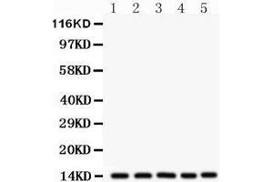 Western Blotting (WB) image for anti-Fatty Acid Binding Protein 1, Liver (FABP1) (AA 6-36), (N-Term) antibody (ABIN3042384) (FABP1 抗体  (N-Term))