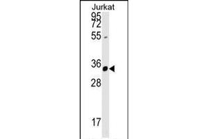 ZFYVE27 Antibody (N-term) (ABIN1539257 and ABIN2848777) western blot analysis in Jurkat cell line lysates (35 μg/lane).