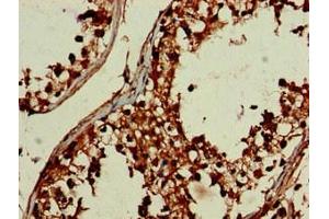 Immunohistochemistry of paraffin-embedded human testis tissue using ABIN7149738 at dilution of 1:100 (DEPDC1B 抗体  (AA 343-529))