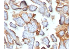 Formalin-fixed, paraffin-embedded human Placenta stained with hCG beta Monoclonal Antibody (SPM105). (CGB 抗体)