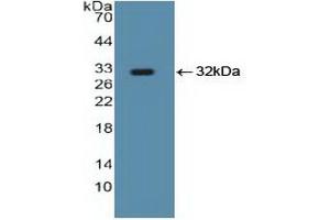 Detection of Recombinant Smad5, Human using Polyclonal Antibody to SMAD family member 5 (SMAD5) (SMAD5 抗体  (AA 210-464))