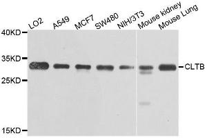 Western blot analysis of extracts of various cell lines, using CLTB antibody. (CLTB 抗体  (AA 1-211))