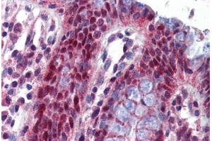Human Colon: Formalin-Fixed, Paraffin-Embedded (FFPE) (NLRP1 抗体  (AA 323-372))