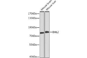 Western blot analysis of extracts of various cell lines, using EML2 Rabbit pAb (ABIN6127842, ABIN6140161, ABIN6140163 and ABIN6218510) at 1:3000 dilution. (EML2 抗体  (AA 150-415))