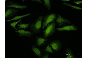 Immunofluorescence of purified MaxPab antibody to LGALS1 on HeLa cell. (LGALS1/Galectin 1 抗体  (AA 1-135))