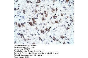 Rabbit Anti-MORF4L2 Antibody       Paraffin Embedded Tissue:  Human neural cell   Cellular Data:  Epithelial cells of renal tubule  Antibody Concentration:   4. (MORF4L2 抗体  (N-Term))