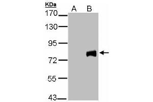 WB Image Western Blot analysis of MID2 expression in transfected 293T cell line by MID2 polyclonal antibody. (Midline 2 抗体  (C-Term))