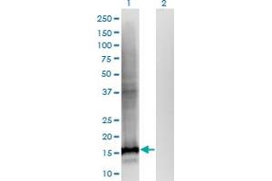 Western Blot analysis of WDHD1 expression in transfected 293T cell line by WDHD1 monoclonal antibody (M01), clone 2F10. (WDHD1 抗体  (AA 1031-1128))