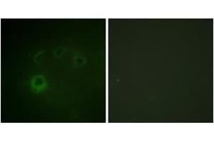 Immunofluorescence analysis of COS7 cells, using p70 S6 Kinase (Phospho-Ser418) Antibody.