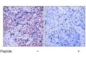Image no. 2 for anti-3-phosphoinositide Dependent Protein Kinase-1 (PDPK1) (Ser241) antibody (ABIN197100) (PDPK1 抗体  (Ser241))