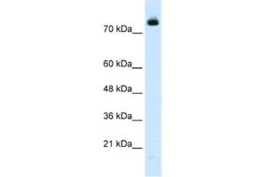 Western Blotting (WB) image for anti-Zinc Finger Protein 261 (ZMYM3) antibody (ABIN2460974)