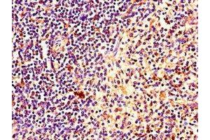Immunohistochemistry (IHC) image for anti-PTEN Induced Putative Kinase 1 (PINK1) (AA 162-272) antibody (ABIN7169153)