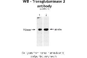 Image no. 1 for anti-Transglutaminase 2 (C Polypeptide, Protein-Glutamine-gamma-Glutamyltransferase) (TGM2) antibody (ABIN346957) (Transglutaminase 2 抗体)