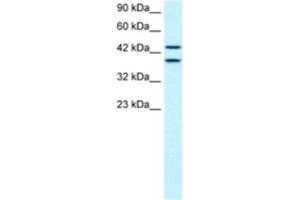 Western Blotting (WB) image for anti-Zinc Finger Protein 839 (ZNF839) antibody (ABIN2460607) (ZNF839 抗体)
