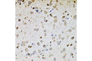 Immunohistochemistry of paraffin-embedded mouse brain using ALDH1A1 antibody. (ALDH1A1 抗体  (AA 48-147))