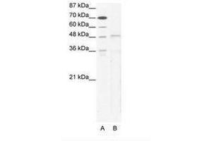 Image no. 1 for anti-T-Box 5 (TBX5) (AA 124-173) antibody (ABIN203164) (T-Box 5 抗体  (AA 124-173))