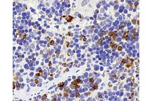 Immunohistochemistry analysis of parafffin-embedded rat spleen using Lysozyme Polyclonal Antibody at dilution of 1:400. (LYZ 抗体)