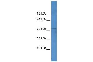 WB Suggested Anti-Ftsj3 Antibody Titration:  0. (FTSJ3 抗体  (C-Term))