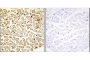 Immunohistochemistry analysis of paraffin-embedded human heart tissue, using CDH13 Antibody. (Cadherin 13 抗体  (AA 331-380))