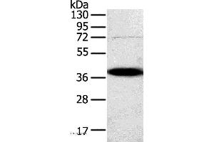 Western blot analysis of A375 cell, using SPARC Polyclonal Antibody at dilution of 1:500 (SPARC 抗体)
