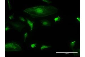 Immunofluorescence of monoclonal antibody to TRIM17 on HeLa cell. (TRIM17 / RNF16 抗体  (AA 75-184))