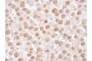 Immunohistochemistry (IHC) image for anti-TAF15 RNA Polymerase II, TATA Box Binding Protein (TBP)-Associated Factor, 68kDa (TAF15) (AA 175-225) antibody (ABIN7453405)