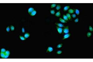 Immunofluorescent analysis of PC-3 cells using ABIN7155274 at dilution of 1:100 and Alexa Fluor 488-congugated AffiniPure Goat Anti-Rabbit IgG(H+L) (KAT5 抗体  (AA 3-512))