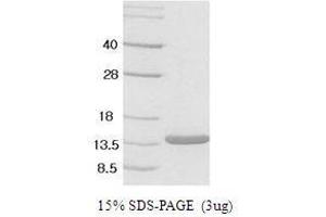 Figure annotation denotes ug of protein loaded and % gel used. (Leptin Protein (LEP))