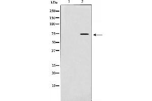 Western blot analysis of MMP 2 expression in LOVO cells. (MMP2 抗体)