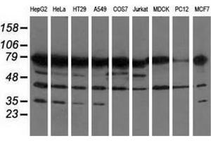 Western blot analysis of extracts (35 µg) from 9 different cell lines by using anti-PUS7 monoclonal antibody. (PUS7 抗体)