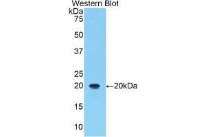 Western blot analysis of the recombinant protein. (ALOX5 抗体  (AA 374-536))