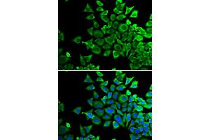 Immunofluorescence analysis of HeLa cells using BAD antibody. (BAD 抗体)