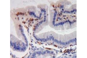Immunohistochemistry (IHC) image for anti-Solute Carrier Family 22 (Organic Cation Transporter), Member 1 (SLC22A1) (AA 413-671) antibody (ABIN7442915)