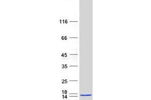 alpha Hemoglobin Stabilizing Protein (aHSP) protein (Myc-DYKDDDDK Tag)