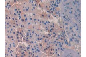 DAB staining on IHC-P; Samples: Rat Adrenal gland Tissue (PIGR 抗体  (AA 343-447))