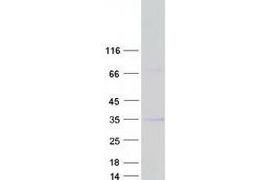 Western Blotting (WB) image for Microfibrillar Associated Protein 2 (MFAP2) (Transcript Variant 3) protein (Myc-DYKDDDDK Tag) (ABIN2725904)