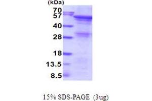 SDS-PAGE (SDS) image for Angiopoietin-Like 2 (ANGPTL2) (AA 22-493) protein (His tag) (ABIN5854091)