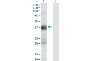 Western Blot analysis of EDNRA expression in transfected 293T cell line by EDNRA monoclonal antibody (M02), clone 2A5. (Endothelin-1 Receptor 抗体  (AA 18-80))