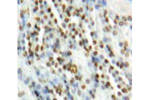 Used in DAB staining on fromalin fixed paraffin-embedded Kidney tissue (MAPK7 抗体  (AA 560-793))