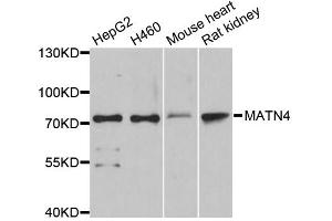 Western blot analysis of extracts of various cell lines, using MATN4 antibody. (MATN4 抗体)