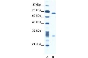 WB Suggested Anti-ASH2L Antibody   Titration: 2. (ASH2L 抗体  (N-Term))