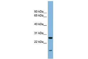 WB Suggested Anti-TRAPPC4 Antibody Titration: 0. (TRAPPC4 抗体  (Middle Region))