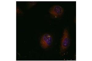 Image no. 3 for anti-Jun Proto-Oncogene (JUN) (AA 89-93) antibody (ABIN197128) (C-JUN 抗体  (AA 89-93))