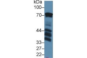 Detection of BLNK in Human Raji cell lysate using Polyclonal Antibody to B-Cell Linker Protein (BLNK)