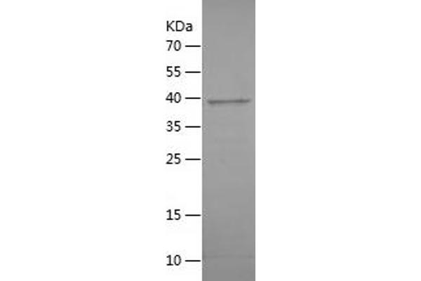 ANAPC15 Protein (AA 1-121) (His-IF2DI Tag)