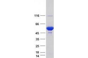 Western Blotting (WB) image for Protein Kinase, CAMP-Dependent, Regulatory, Type I, beta (PRKAR1B) (Transcript Variant 1) protein (Myc-DYKDDDDK Tag) (ABIN2729592)